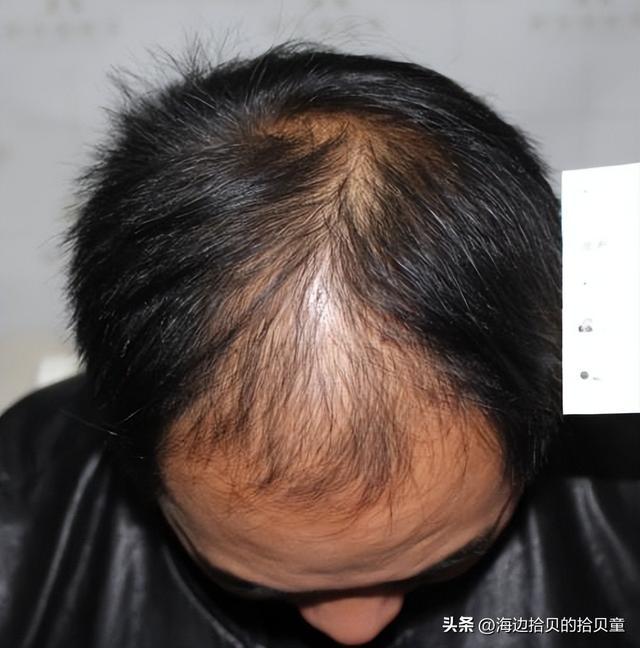 子最好？育发液什么牌子最有效果？pg电子中国网站日本生发液哪个牌(图4)