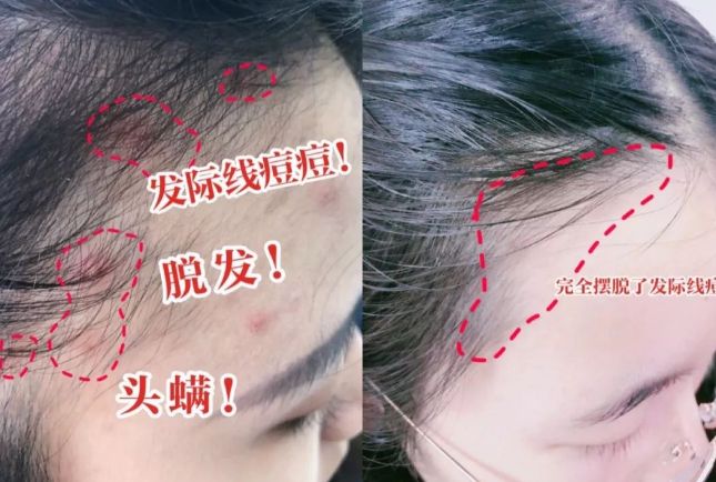 吹干好？10分钟轻松养成女明星「绸缎发」pg电子模拟器免费试玩洗完头自然风干还是(图12)